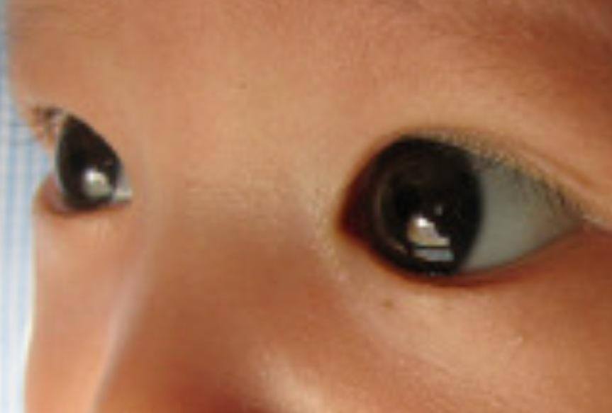 赤ちゃんの白目が青いのはなぜですか 高田眼鏡店 本店公式サイト